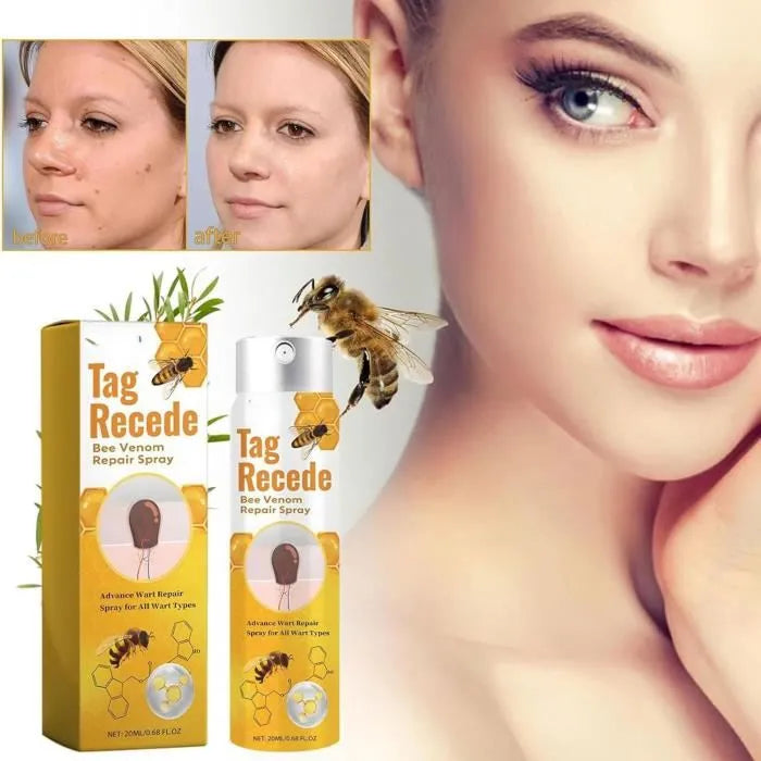 Recede™ Verrugas Fuera, Piel Limpia - [PROMOCIÓN DISPONIBLE SOLO HOY]